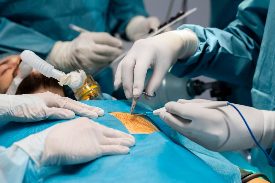 Flap surgery